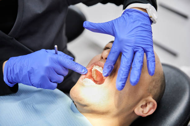 Best Emergency Tooth Extraction in Lawson, MO